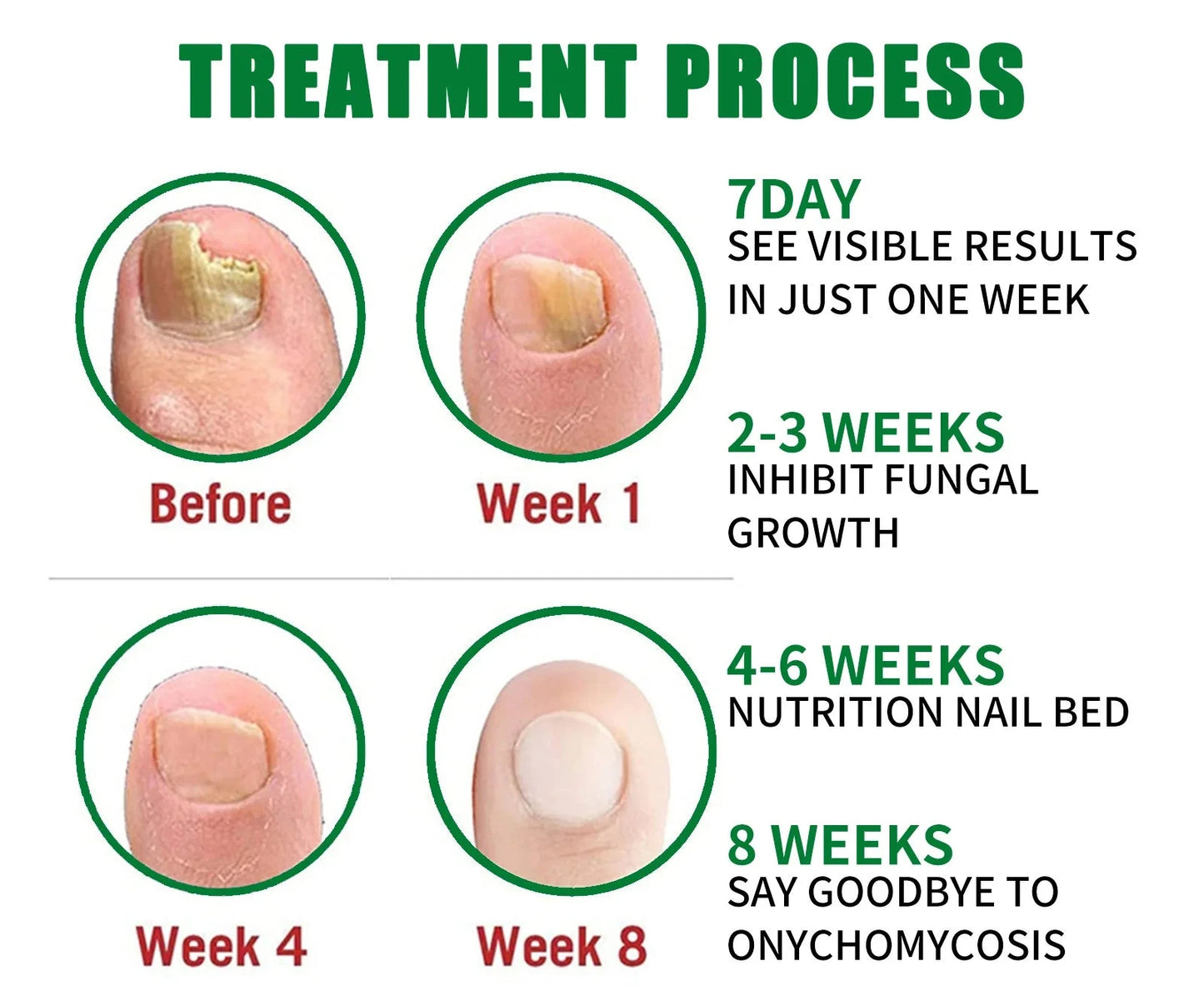 ⭐TRATAMIENTO PARA HONGOS SEVEN DAYS NAIL FUNGUS👨⚕️