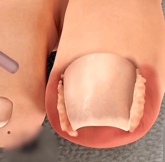 ⭐TRATAMIENTO PARA HONGOS SEVEN DAYS NAIL FUNGUS👨⚕️