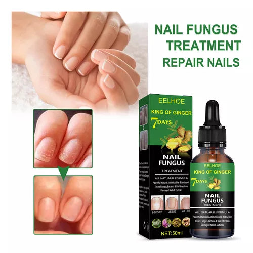 ⭐TRATAMIENTO PARA HONGOS SEVEN DAYS NAIL FUNGUS👨‍⚕️